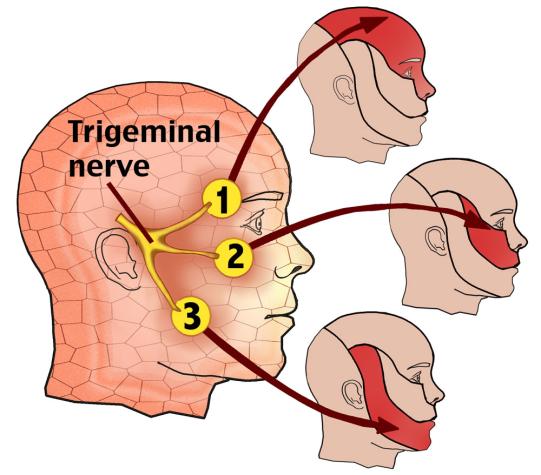 Trigeminal Nerve 三叉神經