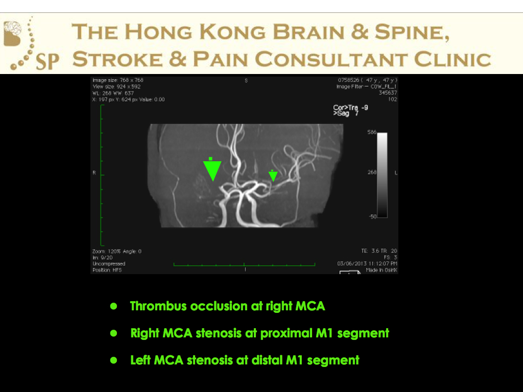 A-47-age-old-man-DAMA-from-HA-003