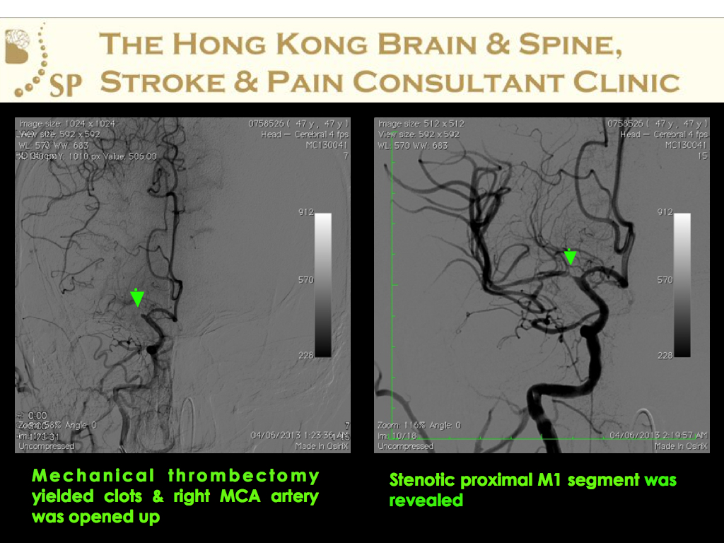 A-47-age-old-man-DAMA-from-HA-004
