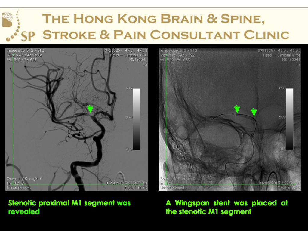 A-47-age-old-man-DAMA-from-HA-005