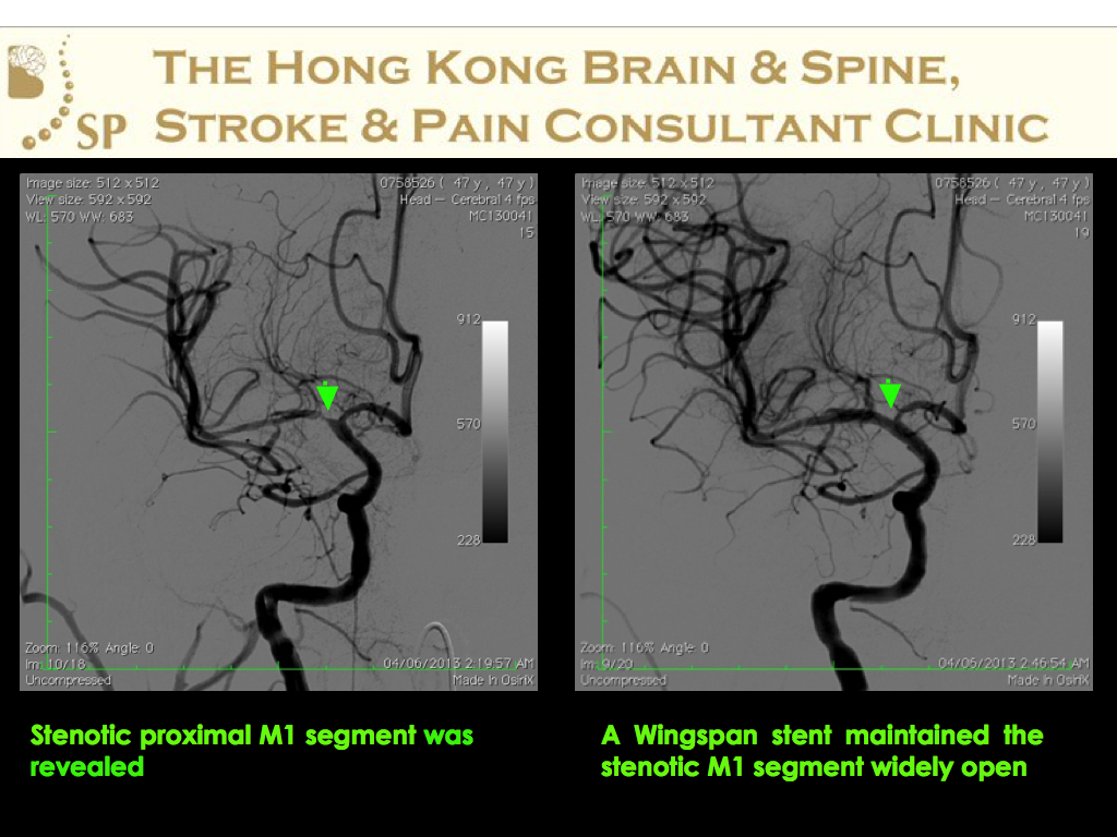A-47-age-old-man-DAMA-from-HA-006