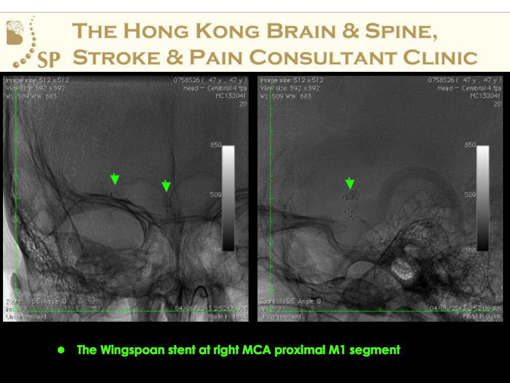 A-47-age-old-man-DAMA-from-HA-007