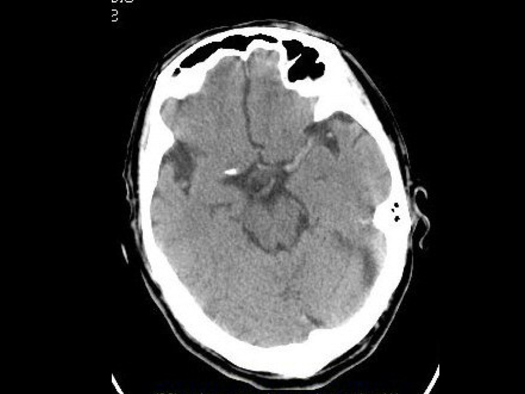 Golden-8-hours-Case-Taxi-Driver-002