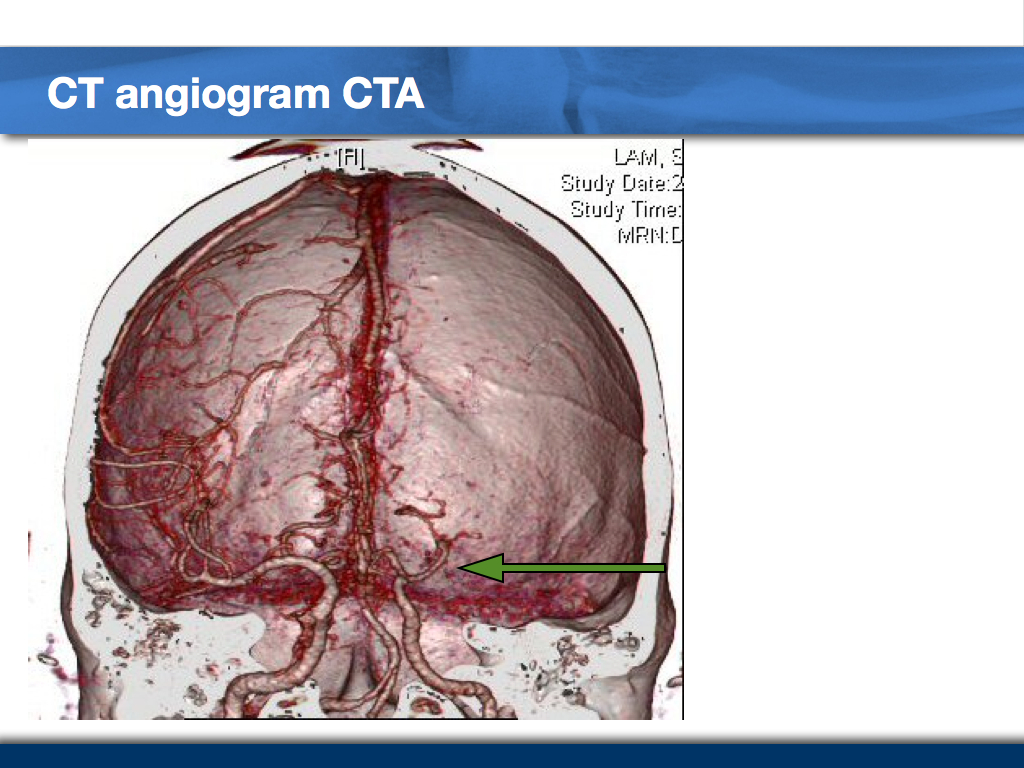 Golden-8-hours-Case-Taxi-Driver-004