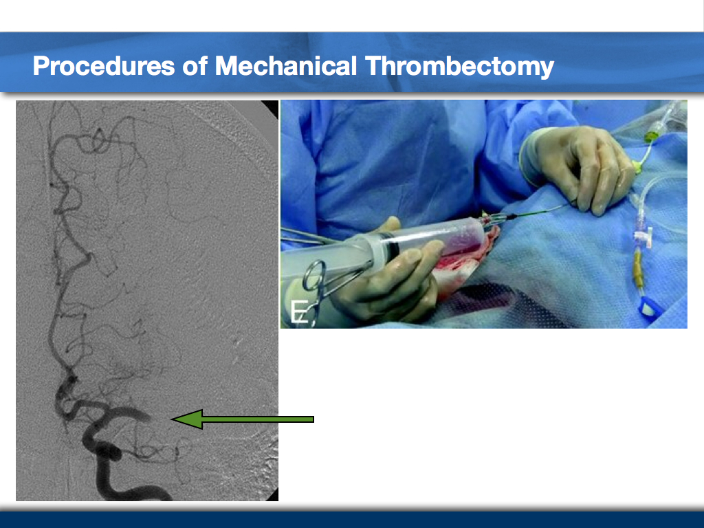 Golden-8-hours-Case-Taxi-Driver-006
