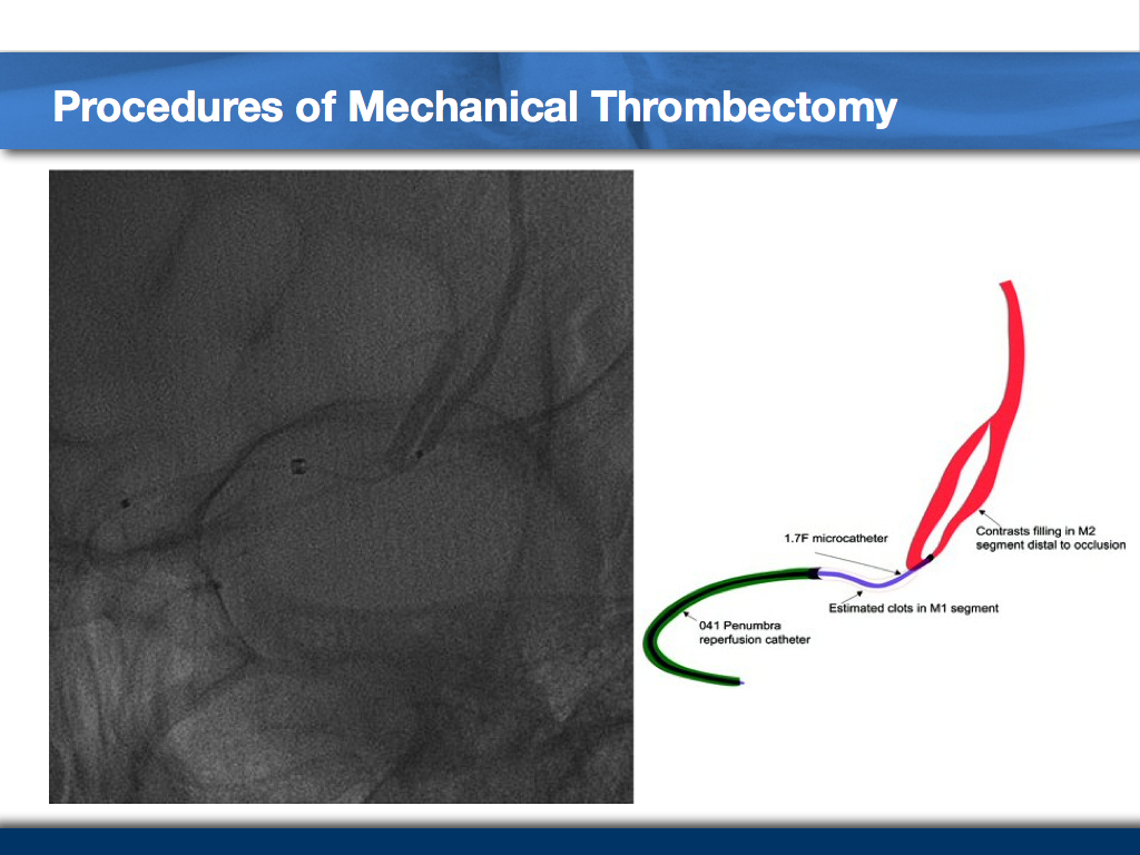 Golden-8-hours-Case-Taxi-Driver-008