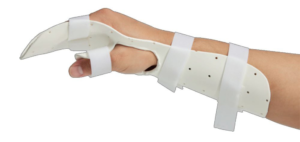 丧失右手的活动能力