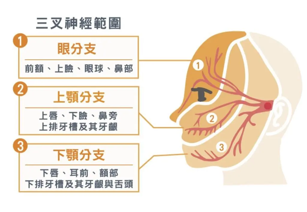 HKBSSP-三叉神經範圍