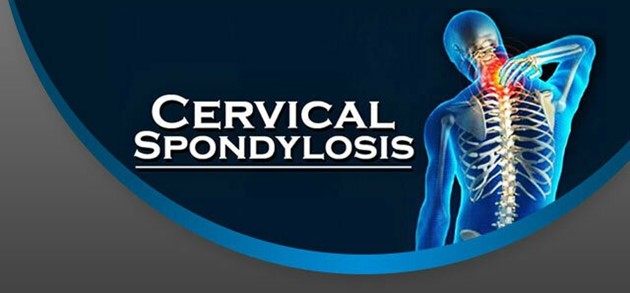 Cervical Spondylosis HKBSSP