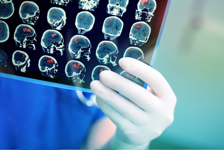 腦血管外科是腦神經外科其中的一個專門範疇，是負責中風的預防、急救和康復治療。然而我們的中風三部曲就是圍繞著這三個中風的里程碑。筆者這一期會以過往的臨床經驗和案例，和讀者解說中風的第一部曲， 就是解說一般人對預防中風的誤解和低估，然而嚴格的中風預防及篩查，才是有效的令中風不會發生。